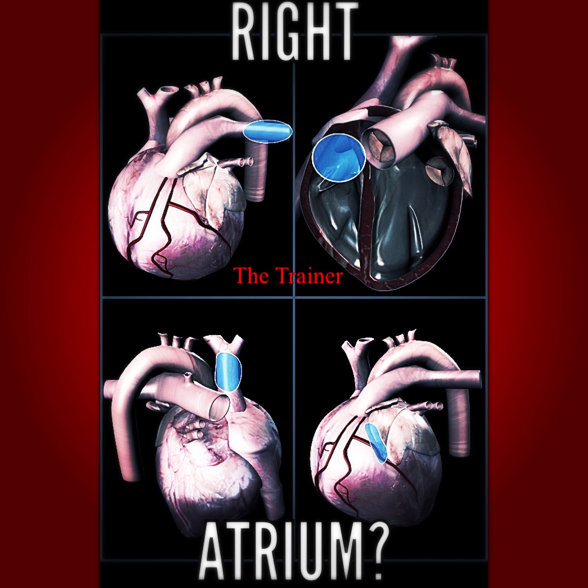 What’s up with your heart? The Trainer 